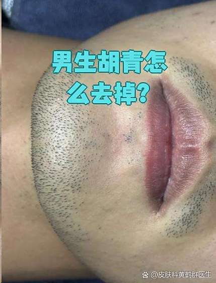 男生一般是什么皮肤截图
