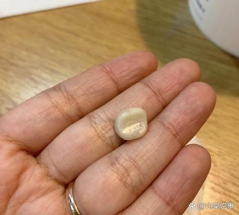 能把一口牙全换掉吗