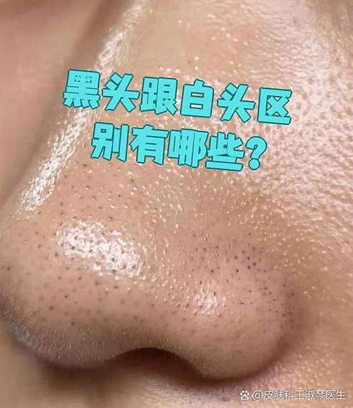 黑头白头