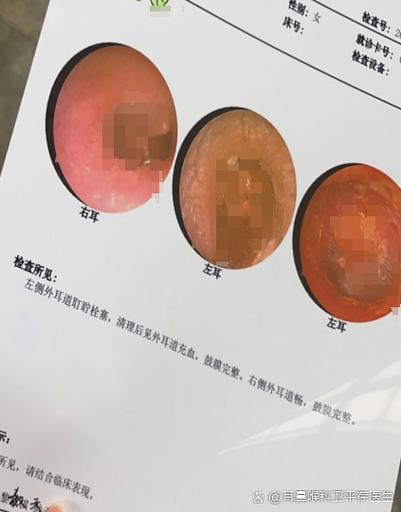 耳朵里面时不时有咚咚咚的声音