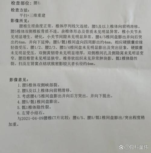 病情分类1 2 3 4