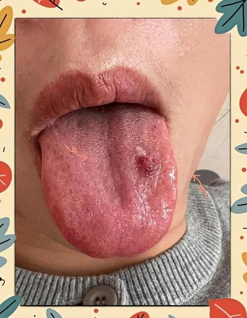 儿童强迫症早期症状截图