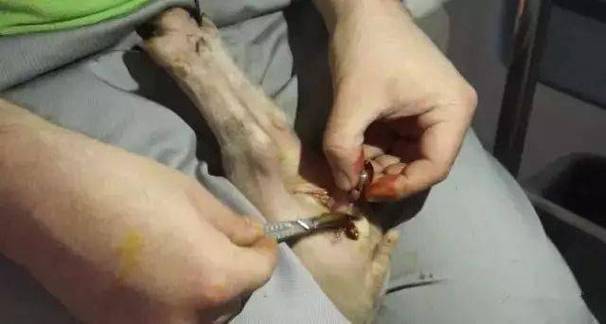 自己割睾丸教程摘除