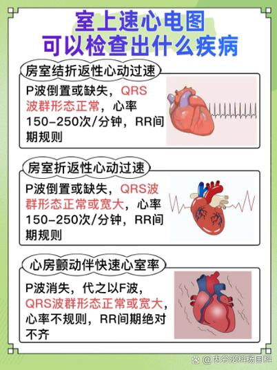 心跳过速是什么原因造成的