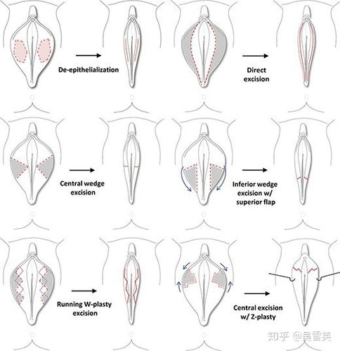 下面大怎么可以缩小截图