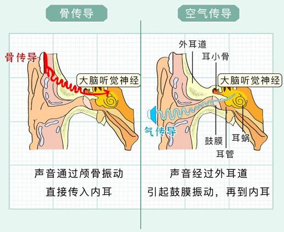 两个耳朵听到的声音不一样是咋办图标