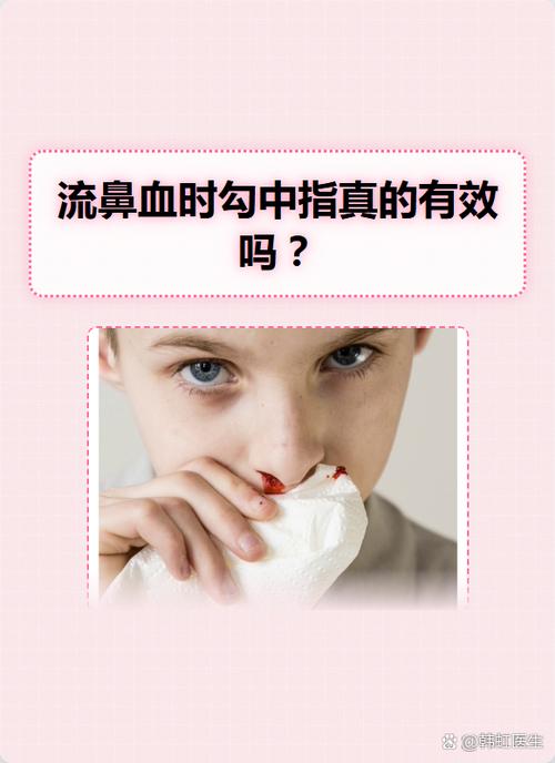 流鼻血特效偏方截图