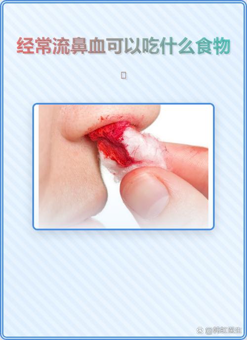 大量流鼻血后怎么补血