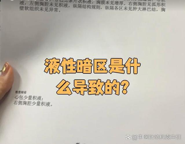 nv暗指什么