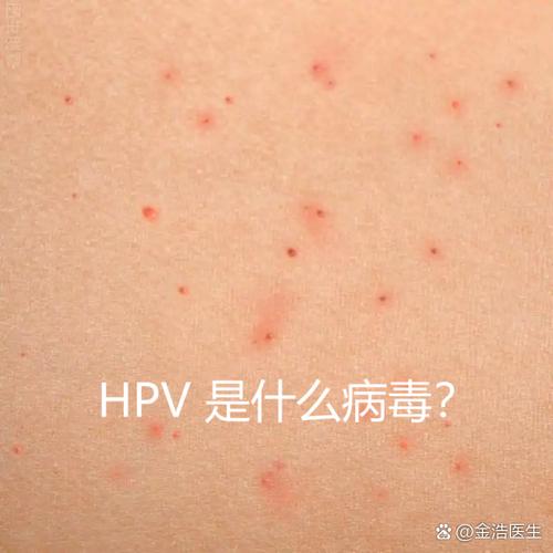 hpv病毒是dna病毒还是rna病毒