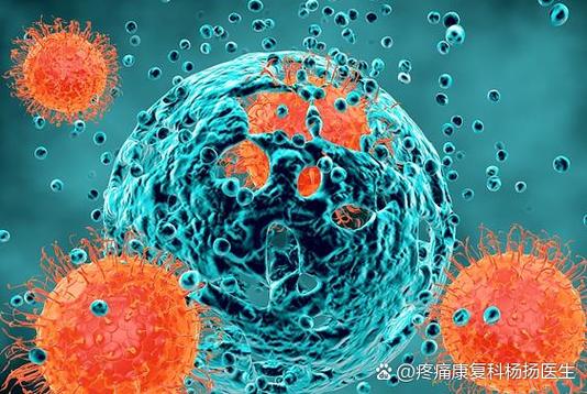 MT是几期癌症