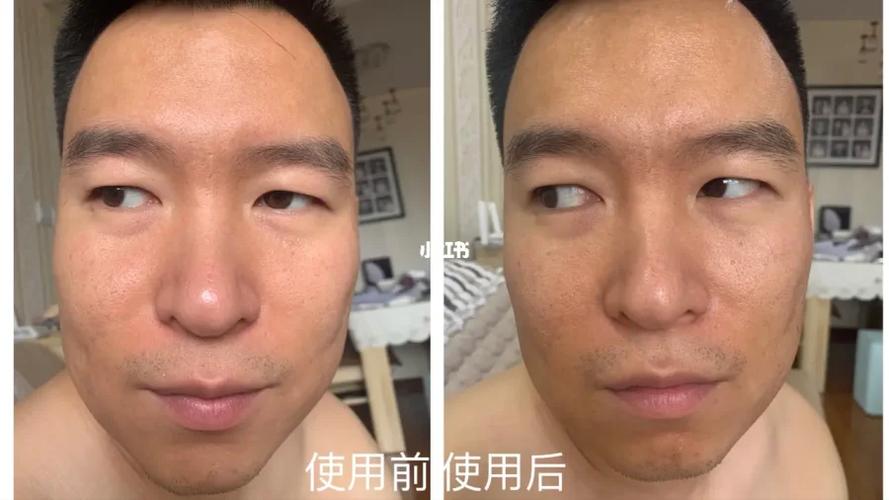 雅萌使用前后对比