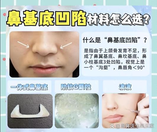 填充的方式有哪五种