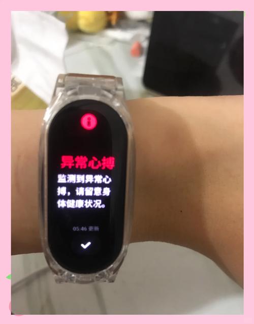 小米手环4亲友关爱不提醒