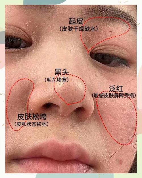 脸上起皮什么原因怎么解决截图