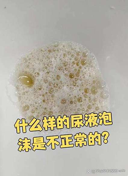 什么叫泡沫