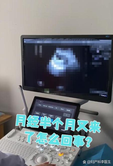 隔半个月又来月经是怎么回事图标