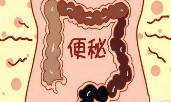解决便秘的最佳方法