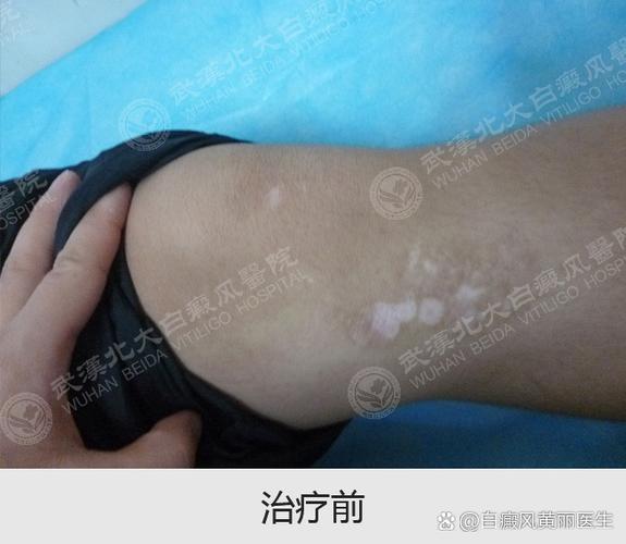 电脑屏幕上有一块白色方块,怎么办图标