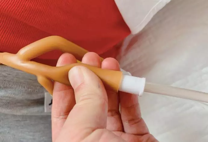 挤压尿管的方法