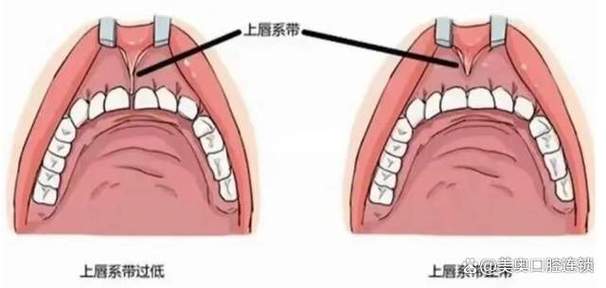 女人上门牙缝暗示什么截图