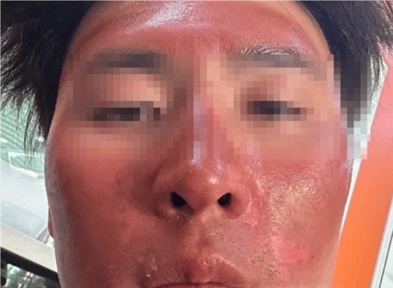 面膜不小心弄到嘴了截图