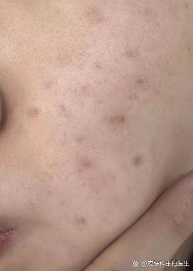 后置摄像头轻微黑斑截图
