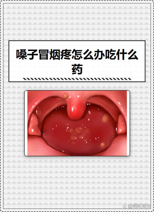 嗓子冒烟了最怕三个药