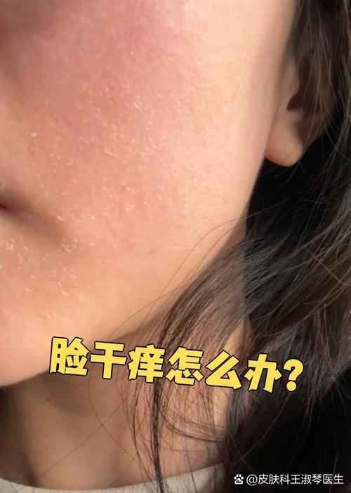 脸部干痒