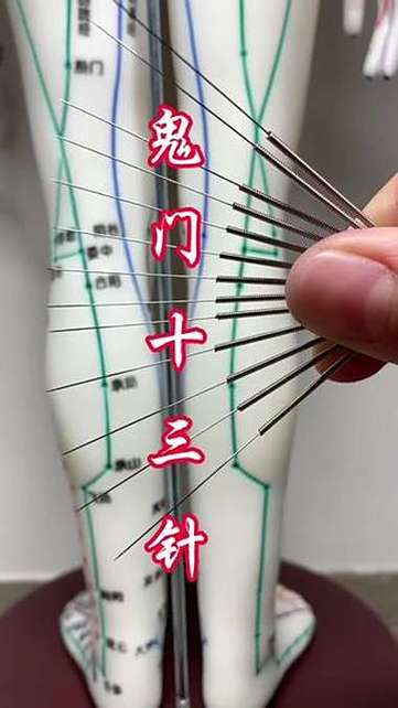 正规医院鬼门十三针截图
