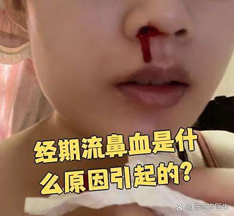来月经的时候流鼻血是怎么回事