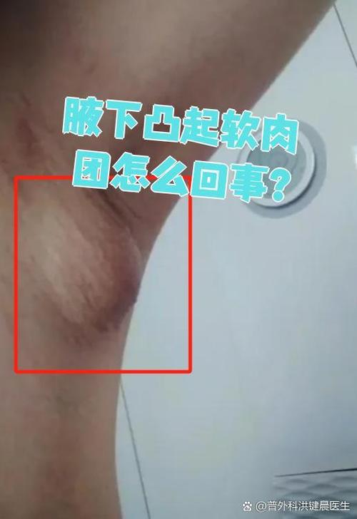 两瓣中间凸出来的肉叫什么图标