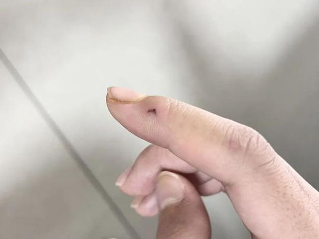 咬过人的仓鼠还能留吗