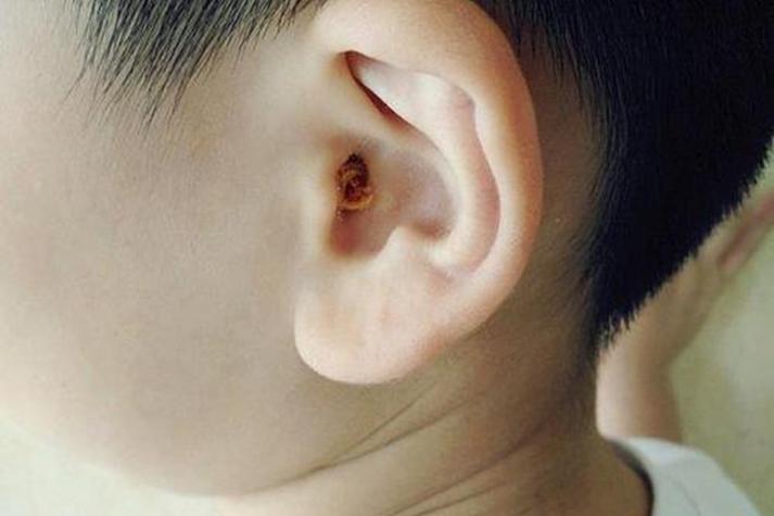 耳朵特殊符号ඉ