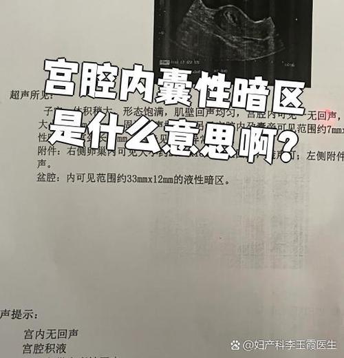 囊性暗区图标