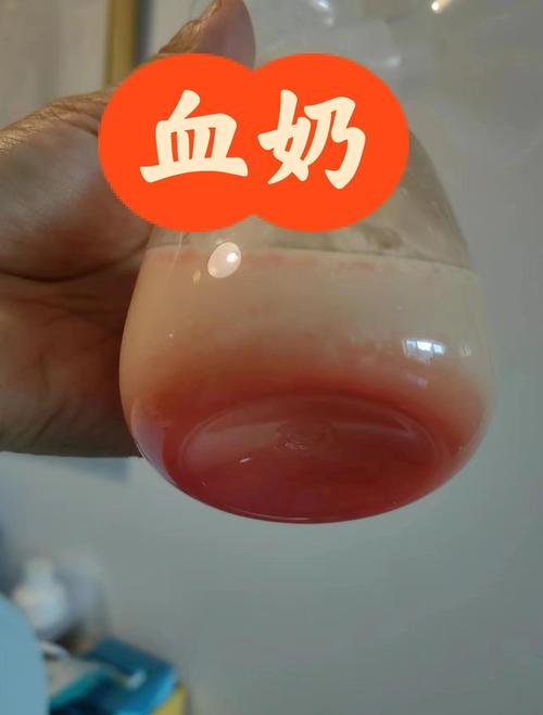 奶堵了吸出来有血