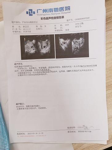 早孕报告单图片
