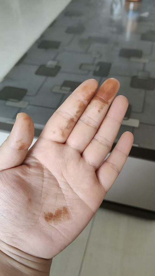 睡醒之后手上有铁锈黄