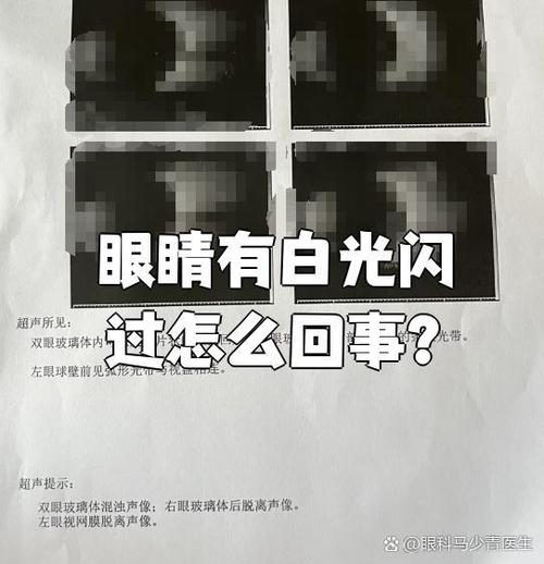 眼睛里有白光闪过