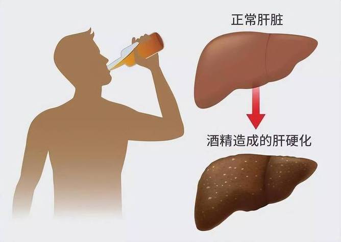 酒精120属于什么程度