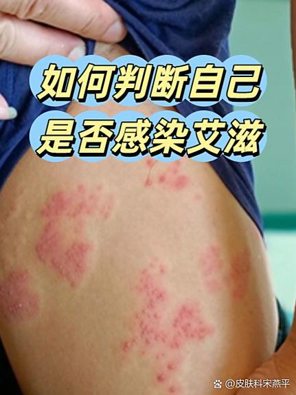 洗过的衣服还有艾滋病毒吗