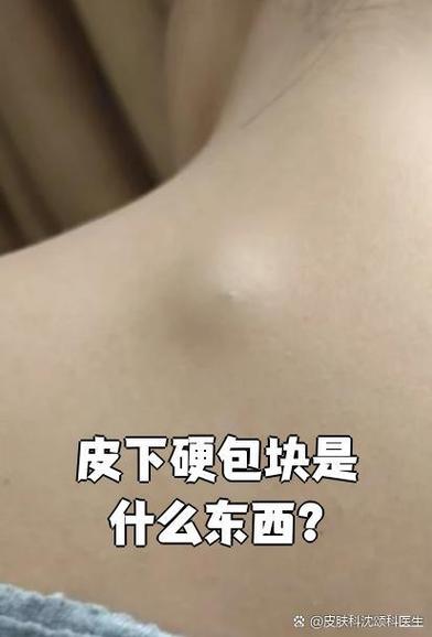 实体包块