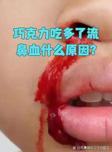 巧克力 鼻血图标