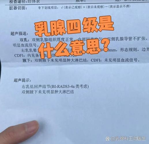 乳腺结节4级是什么意思