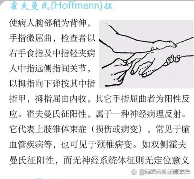 手指抽搐