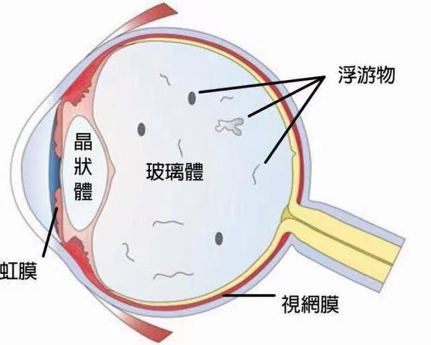 眼睛前面好像有东西在飞