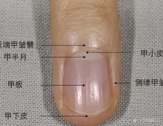 指甲出现竖纹的原因