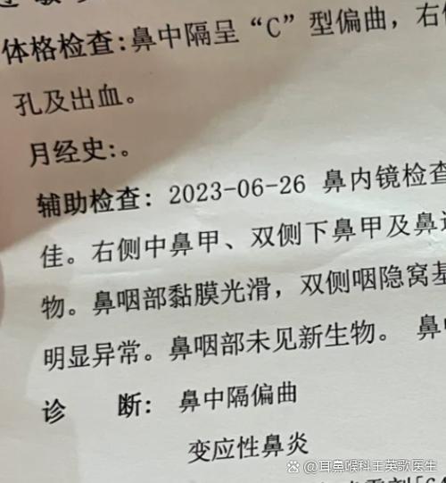 流鼻血需要做几样检查