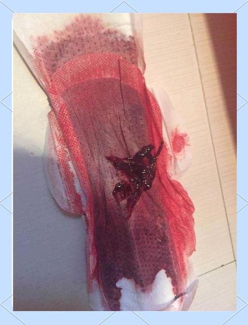 姨妈血干了粘在身上图标