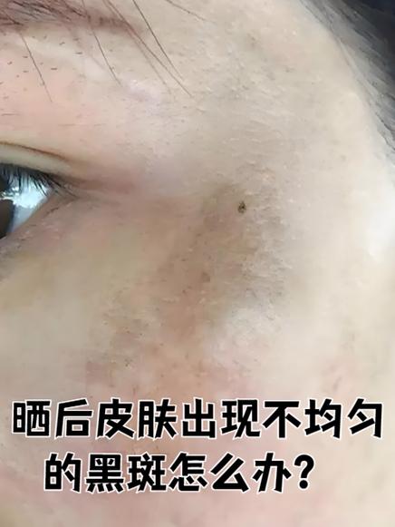 如何解决皮肤显示不出的问题